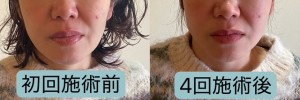 ビフォーアフター