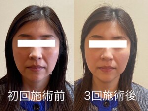 ビフォーアフター