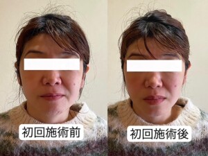 ビフォーアフター